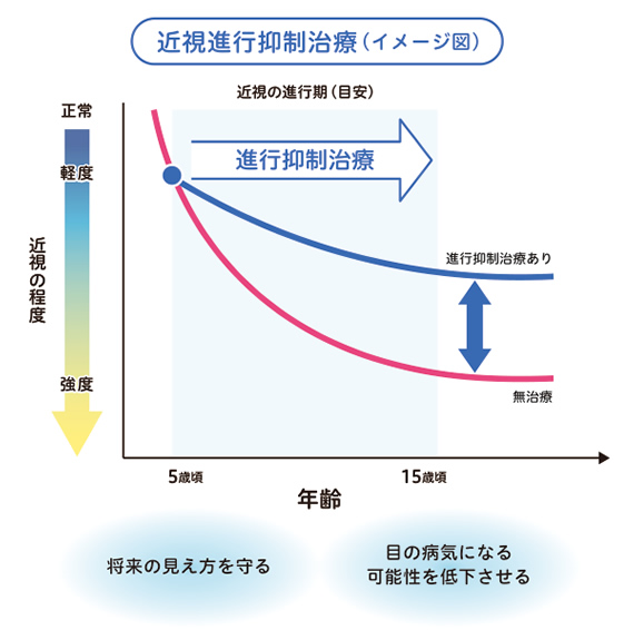リジュセアミニ点眼のグラフ