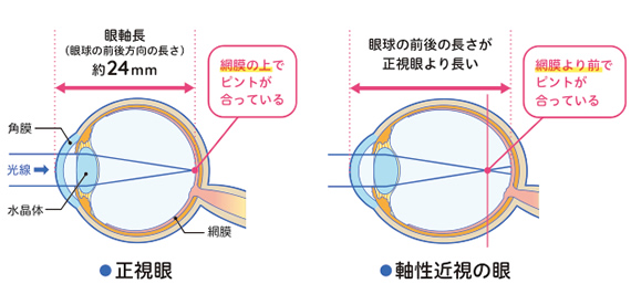 リジュセアミニ点眼のグラフ
